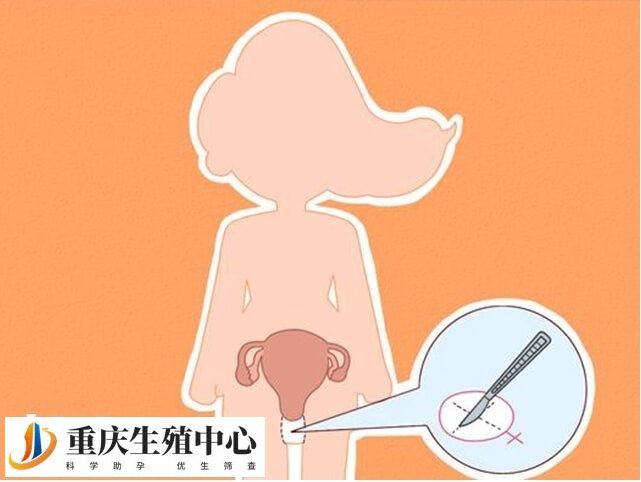 女性没有子宫对身体有哪些影响